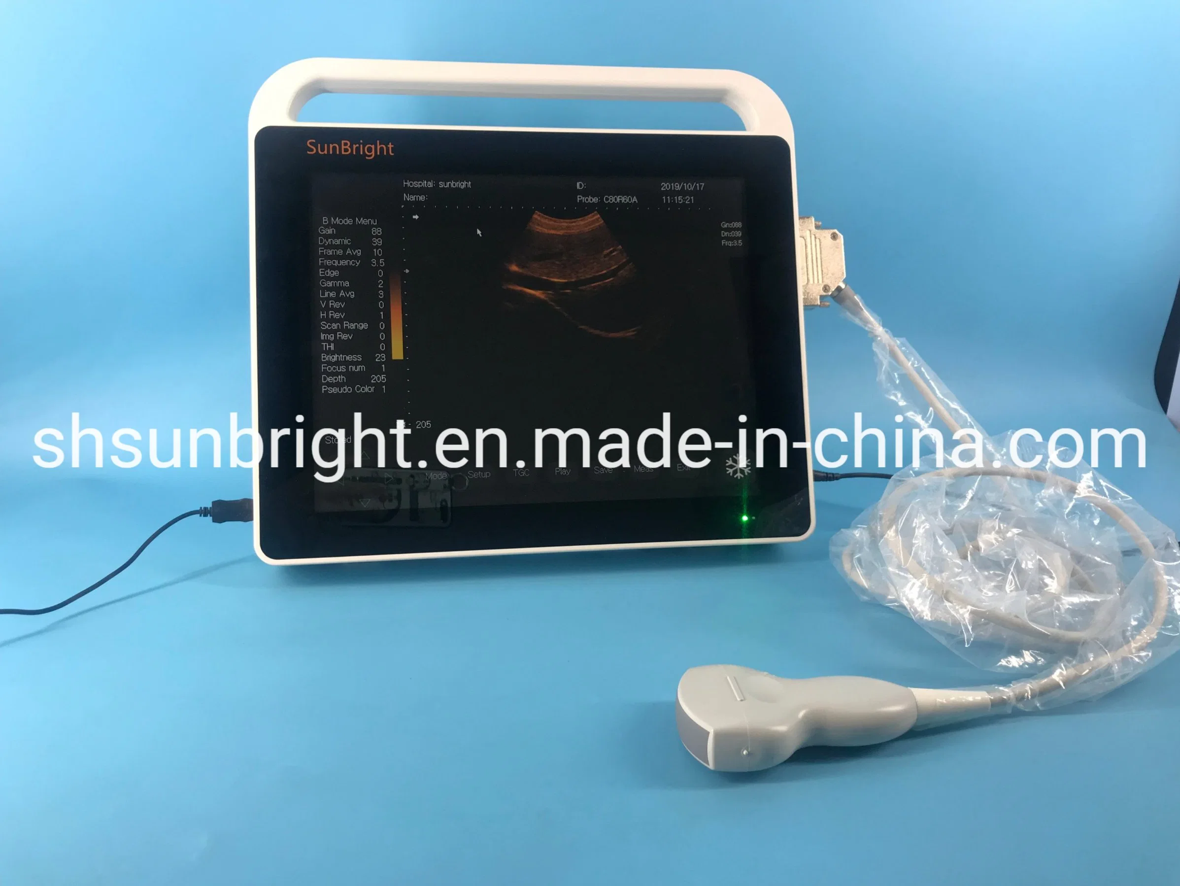 MSK Touchscreen Ultraschall Preis Laptop Medizinische Ultraschall Touch USG