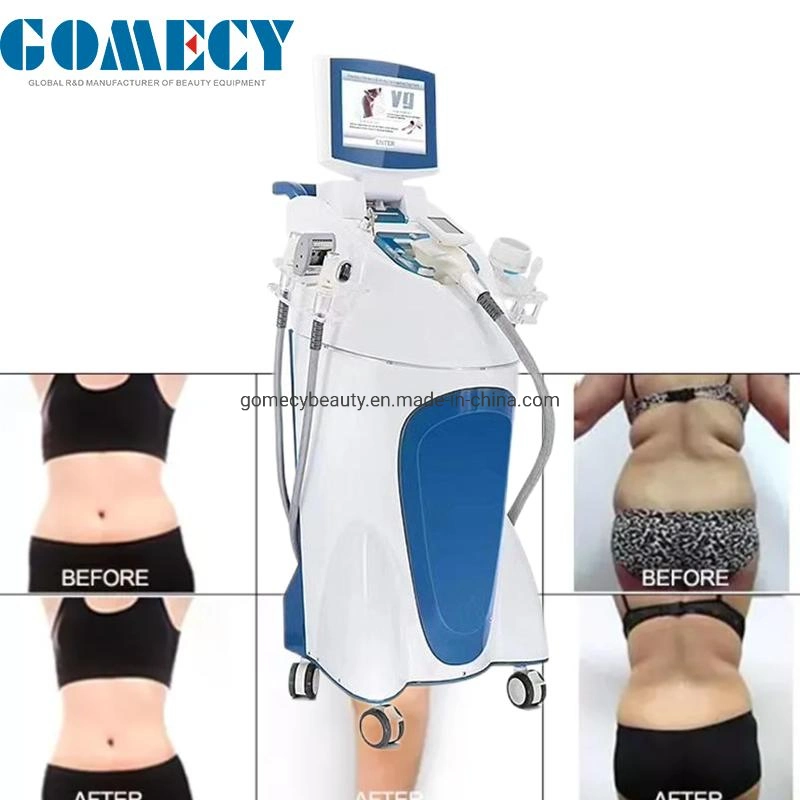 Vácuo de cavitação vertical perda de peso RF pernas do corpo de moldagem Braços Abdomen HIPS Machine