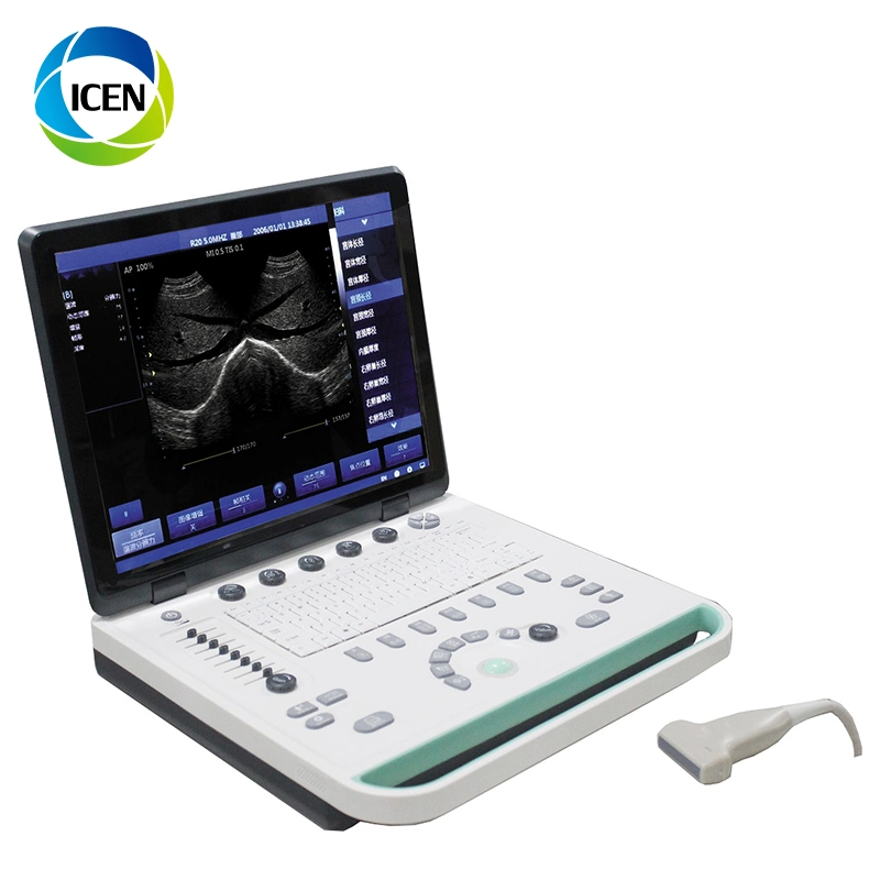 IN-A032-2 Diagnóstico Full Digital Laptop Home Ultrasound Scanner Ultrasonido máquina