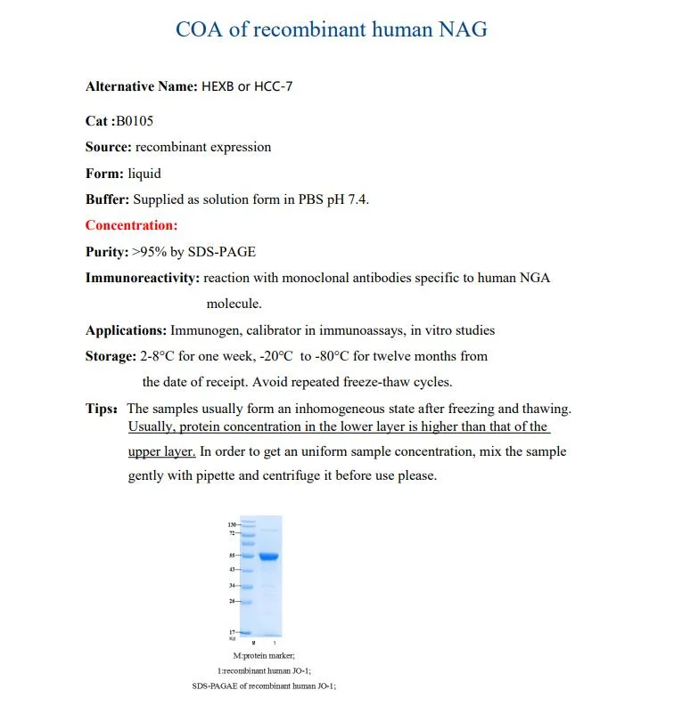 La alta calidad humana recombinante HEXB/HCC-7 proteínas anticuerpo de NAG