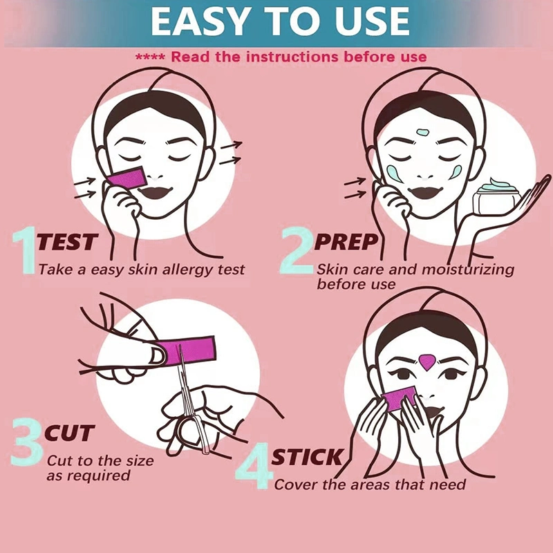 Respirante et confortable pour améliorer la solution anti-enroulement du nez et diluer Plis nasolabiaux produits médicaux patch facial