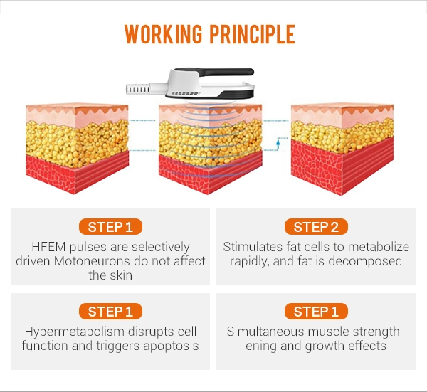 EMS Sculpt EM Slim EMS Sculpt Behandlung in der Nähe von mir Fitness Mitte