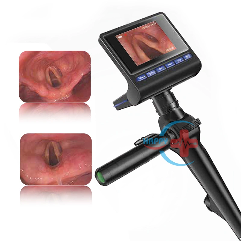 Hc-G032e Laringoscopio/Airway Móvil Endoscópico de Video Digital Portátil para Operaciones de Otorrinolaringología