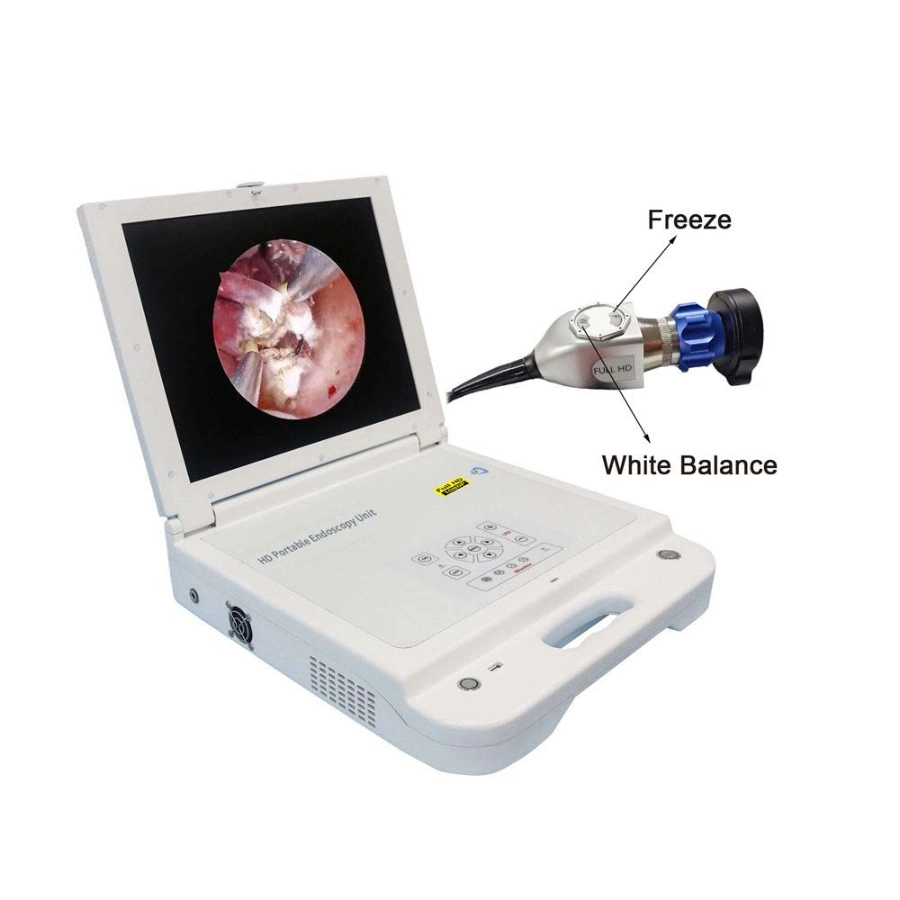 Tragbarer medizinischer HD-Monitor mit LED-Lichtquelle, Ent CCD-Endoskop Tragbare Endoskopieeinheit Der Kamera
