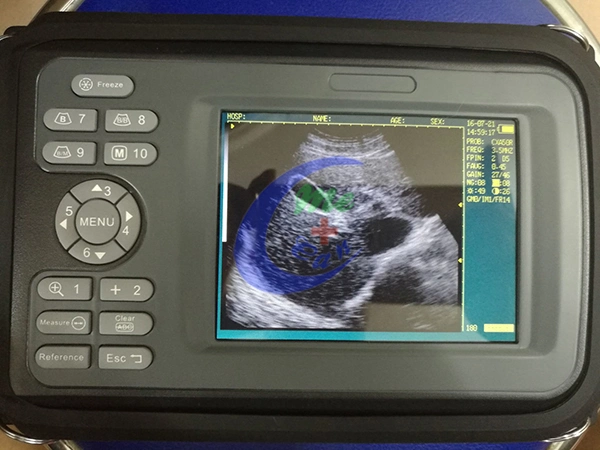 Portble Veterinary Ultrasound Scanner Pet Clinic Cow Pregnancy Test