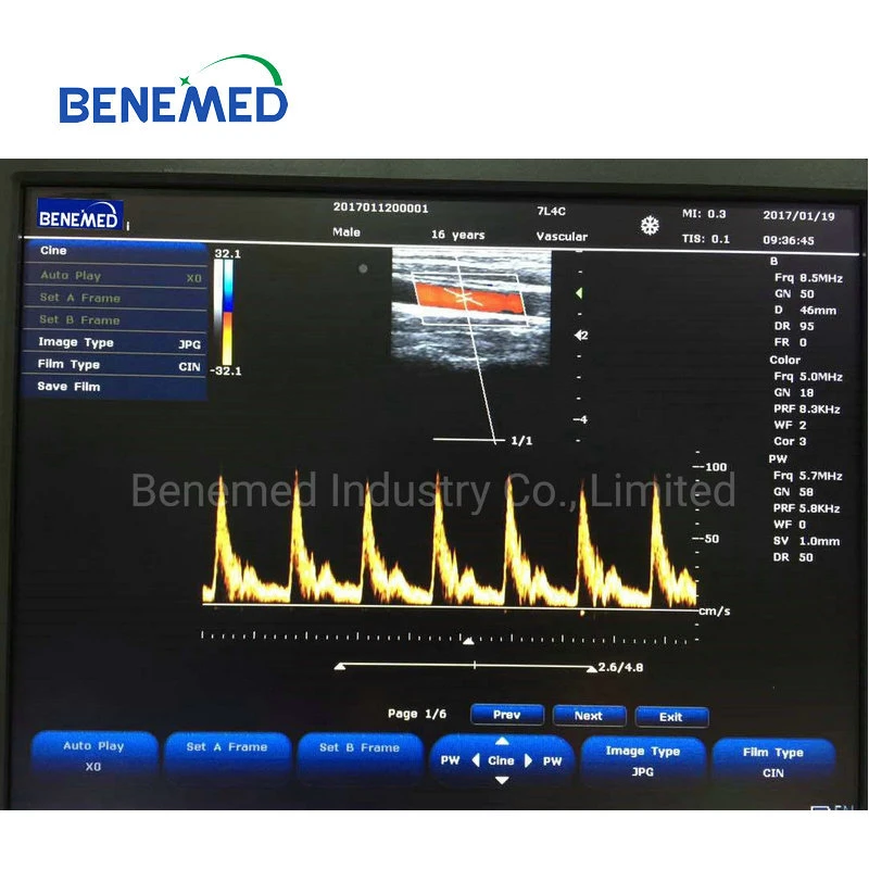 Populares Ecógrafo Doppler Color portátil equipos hospitalarios