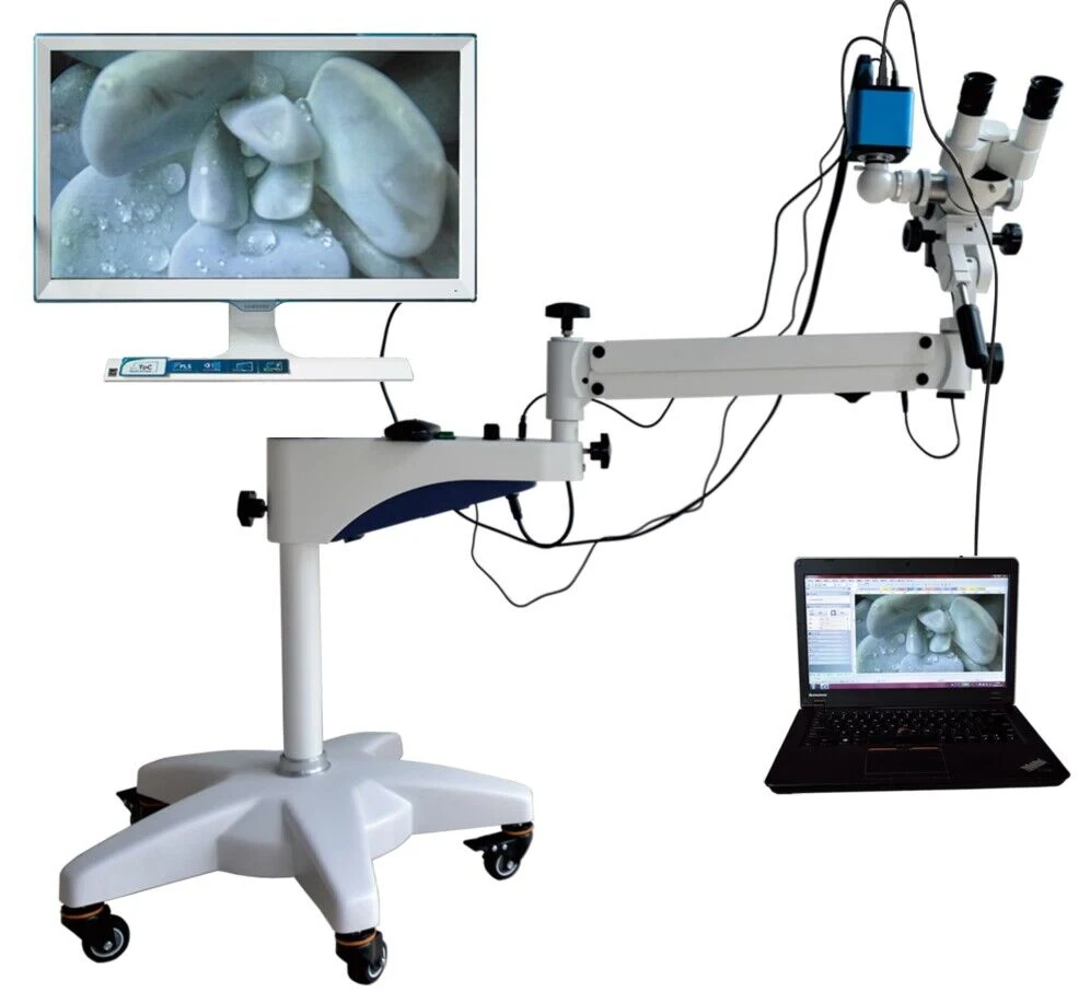 Poweam Medical LED/Halogen Colposcopy/Colposcopic Examination