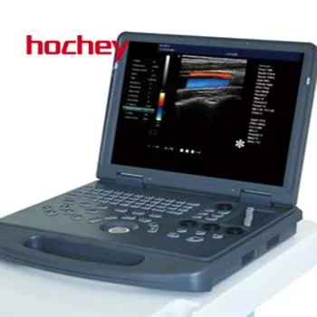 Médico de hochey portátil 4D de la máquina de ultrasonido Doppler Color de la fábrica