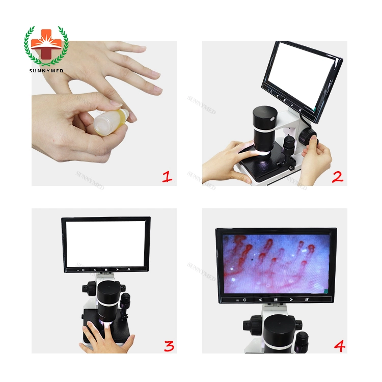 Micro Circulation Medical Hospital Machine Capillary Microscope