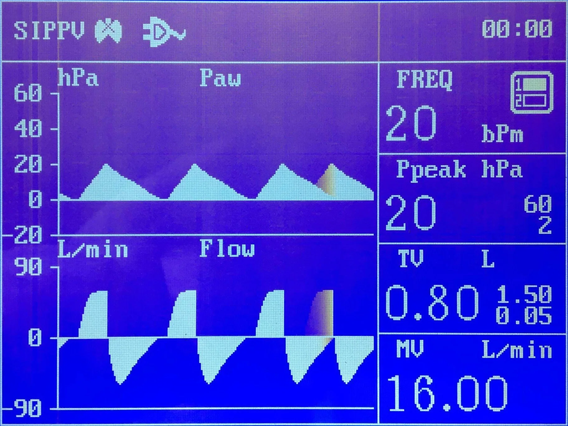 Hôpital matériel médical équipement chirurgical d'anesthésie appareil d'instrument