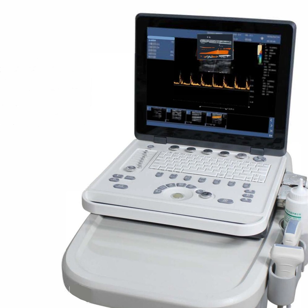 Maq5V Medical Vet 4D Color Doppler ultra-som portátil Scannere a máquina