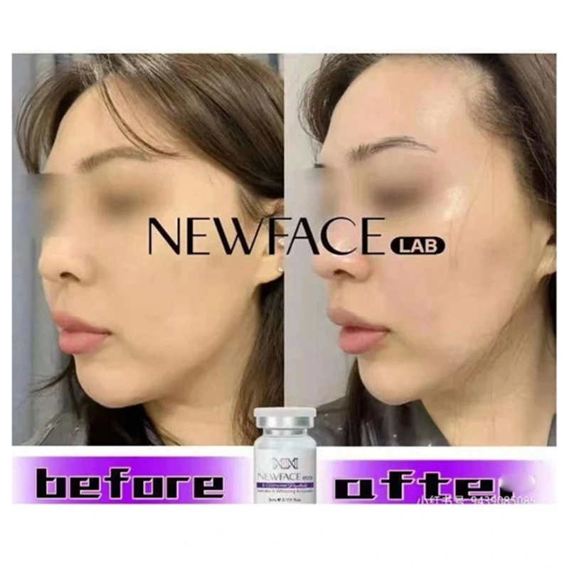 Korean Beauty Product Newface Lab Enhances Skin Elasticity