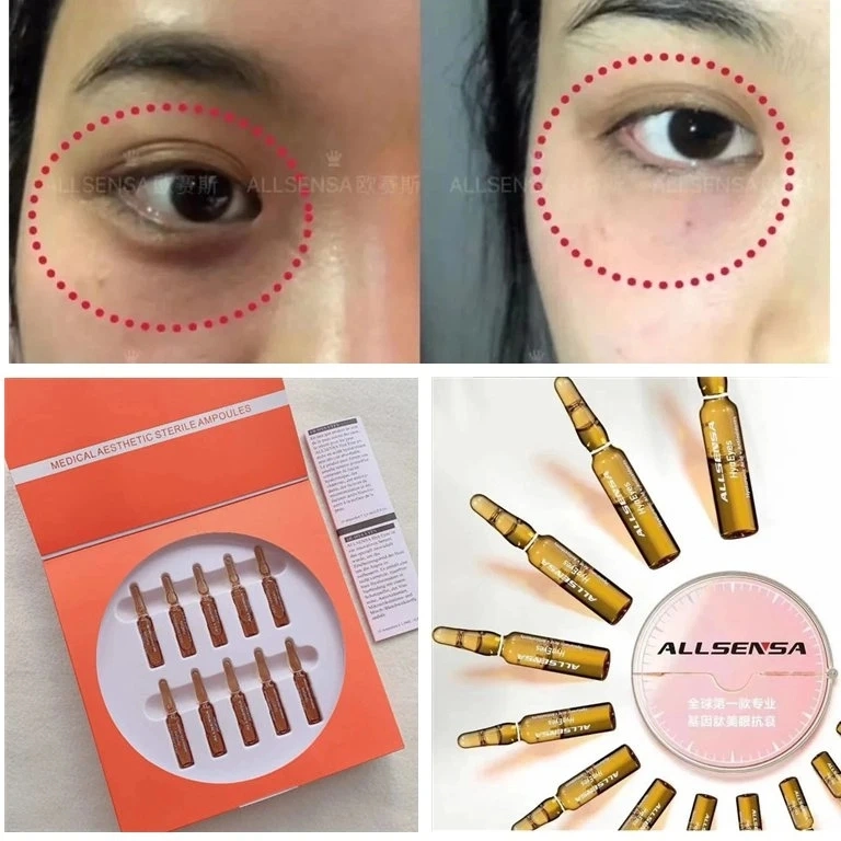 Allsensa Hyaeyes Antioxidantien periocular Gene Peptide for Dark Eye Circle Eyebag Augenfalten Entfernung Hyaluronsäure Injektion Haut Booster