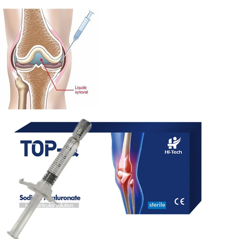أعلى-Q1مل حقن ارتباط الركبة بحمض هيالورونيك للجيل لعلاج التهاب المفاصل في الركبة