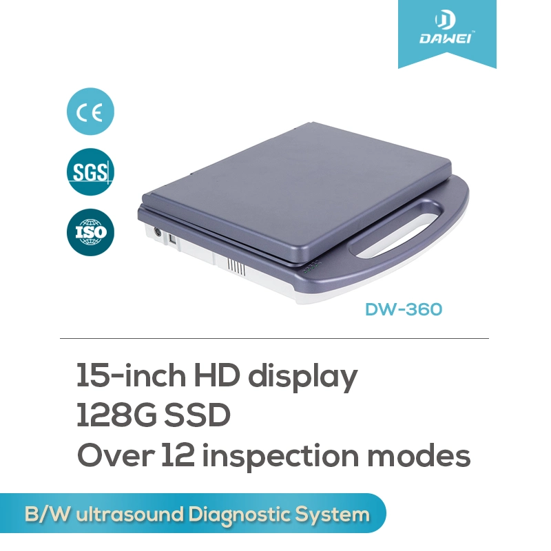 Espera Ultra-Long portátiles en blanco y negro El equipo de diagnóstico por ultrasonido abdominal Obstetricia.