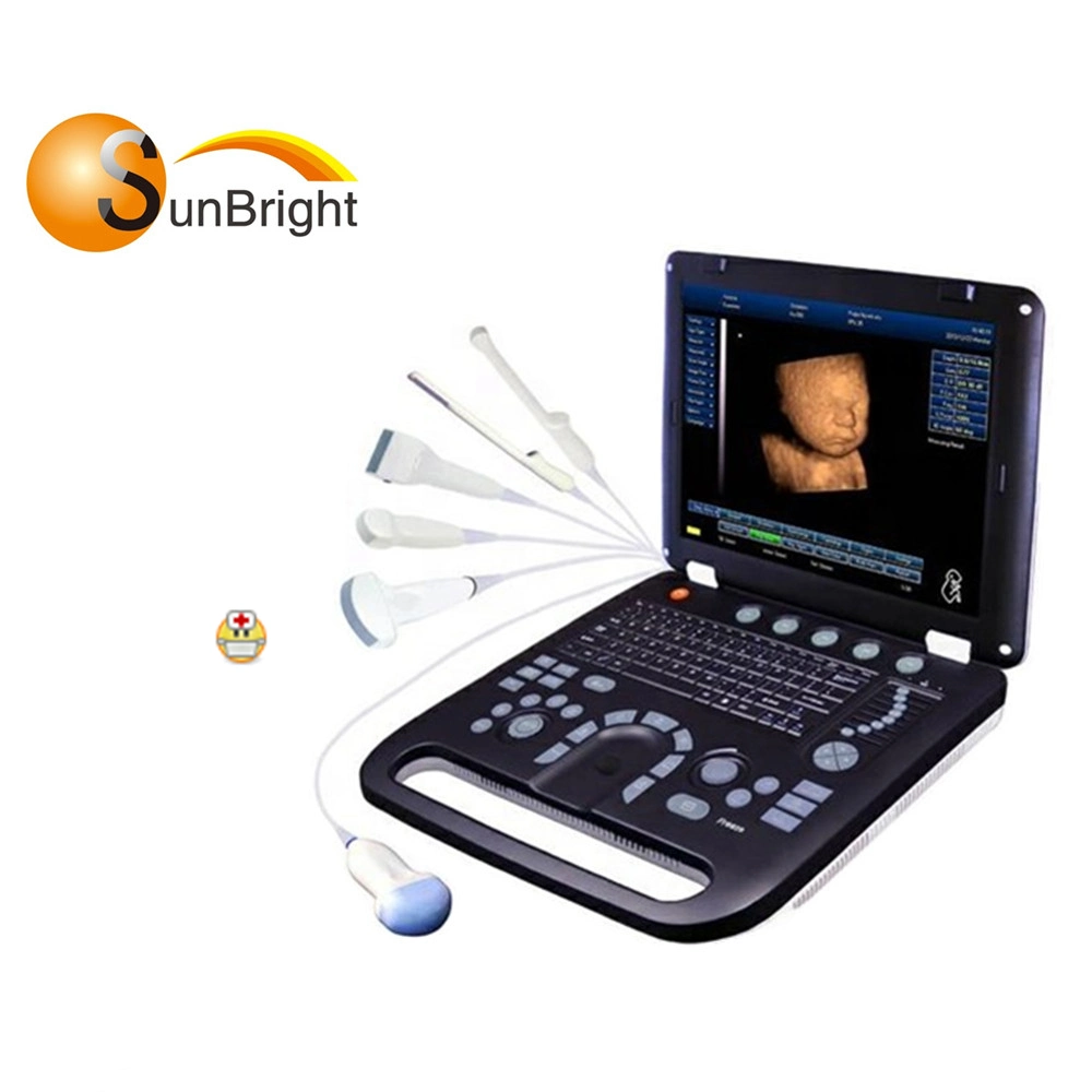 15 Inch Pw Auto Trace Measurement Color Doppler Ultrasound Medical Scanner