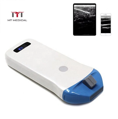 Mini WiFi 128 Elements Wireless Ultrasound 10MHz/14MHz Linear Probe Scanner for Android&Ios&Windows