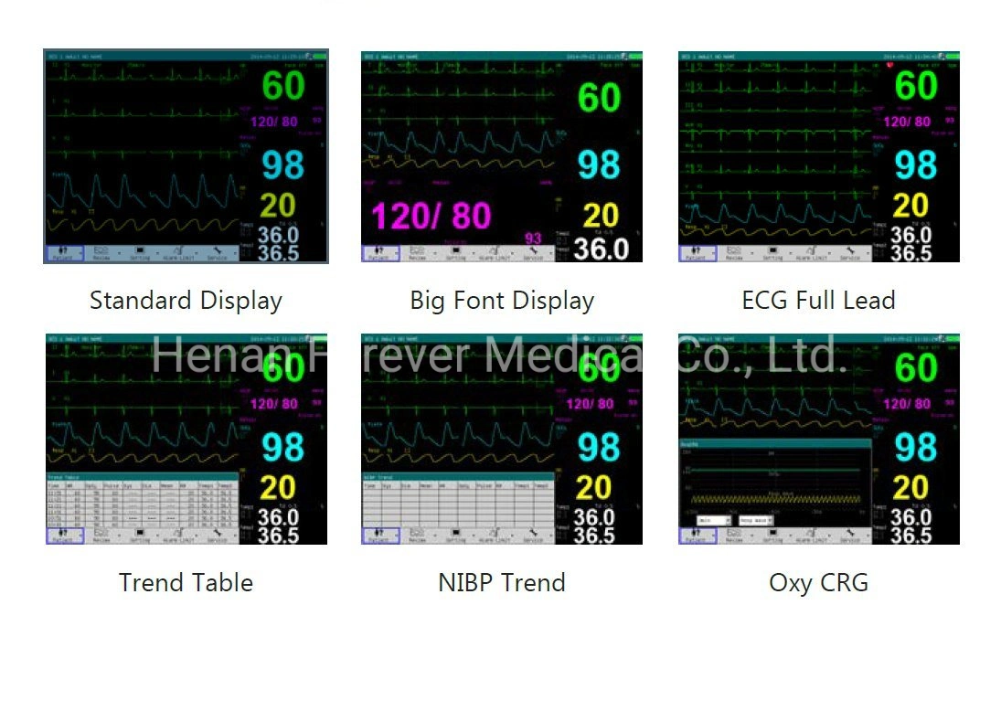 Multi-Parameter Patient Monitor CE Aooroved High End Hospital Machine