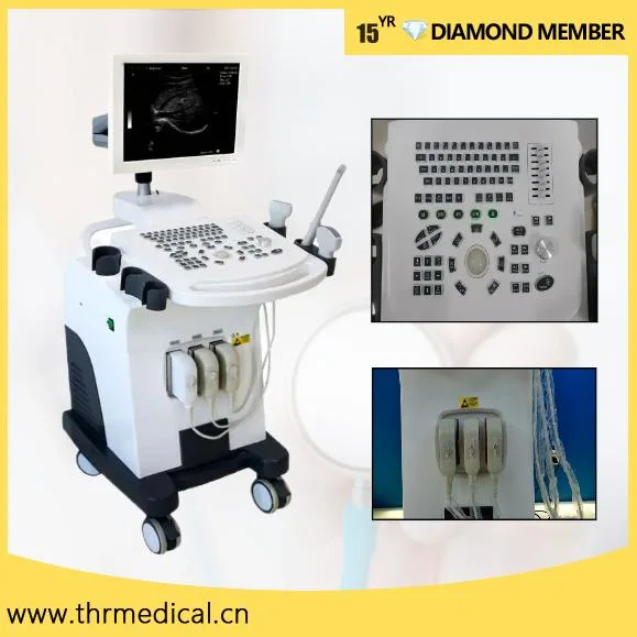 Hospital Equipment B/W Trolley Ultrasound Scanning Machine for Human (THR-US370)