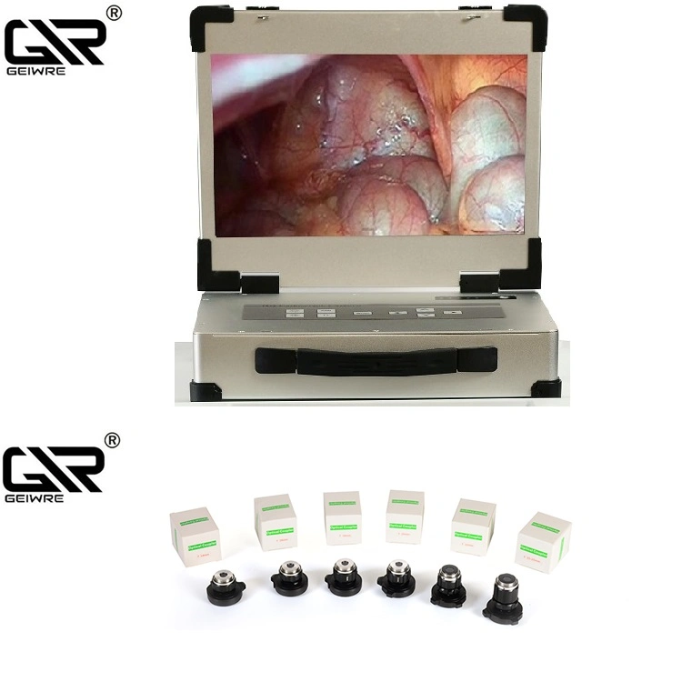 Sortie HDMI vidéo médical de l'endoscopie