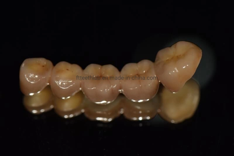 Full Contour Zirconium Bridge Made in China Dental Lab