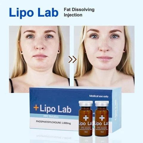 Hot Sale New Product Lipo Lab V-Line, High Safety, Quick Effect, Small Side Effects, Rapid Shaping Injectable for Dissolve Jaw Line Fat Lemonbottle