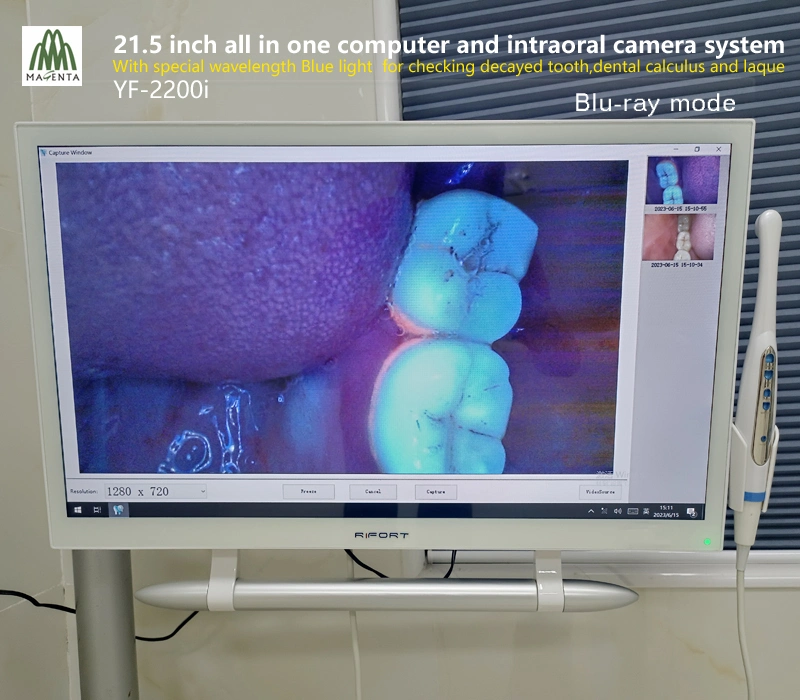 High Configuration 21.5" Touch Screen Windows 10 System and Dental Oral Camera Unit with Blue Light for Decayed Tooth/Calculus and Plaque