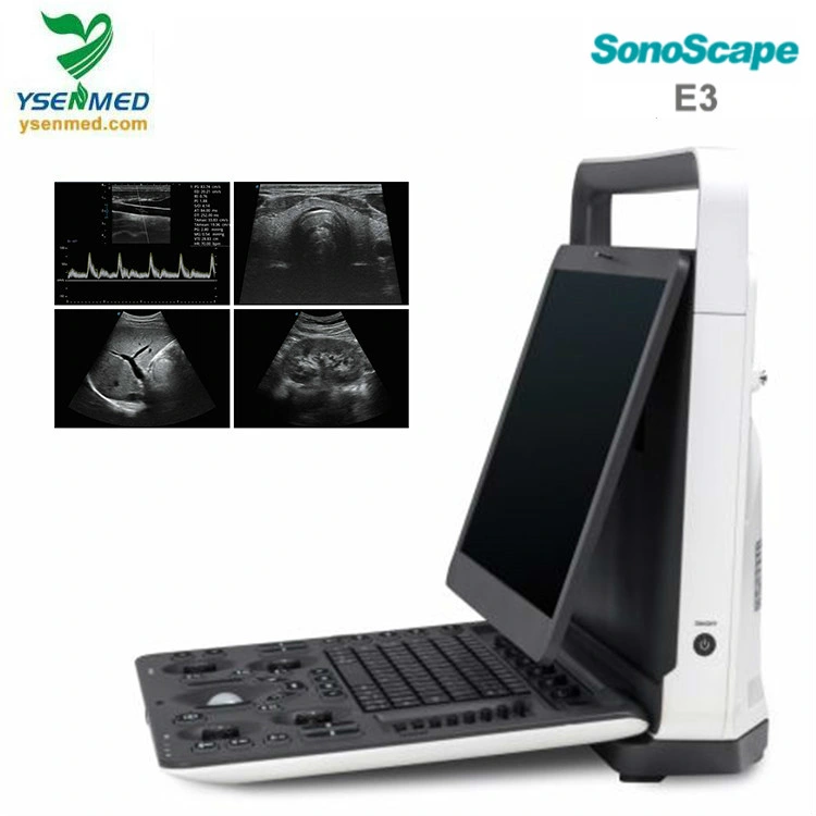 Medical 15,6 pouces Moniteur couleur LCD haute résolution Sonoscape E3 Doppler couleur