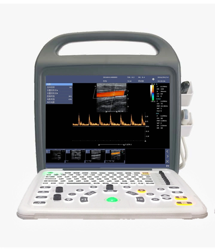 المعدات الطبية الأجهزة الطبية المحمولة جهاز ملون دوبلر صدى الموجات فوق الصوتية الماسح الضوئي