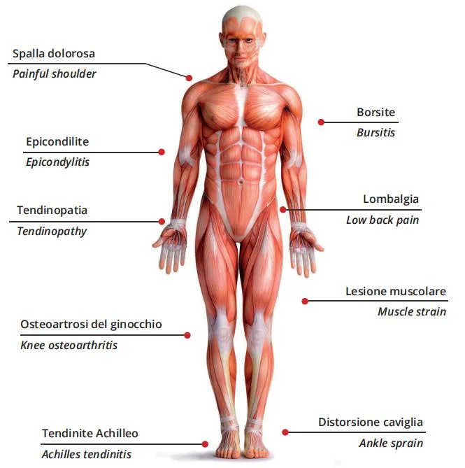 2024 Vente à chaud 60 W laser haute puissance soulagement de la douleur physiothérapie Appareil Equipement physiothérapie laser physiothérapie