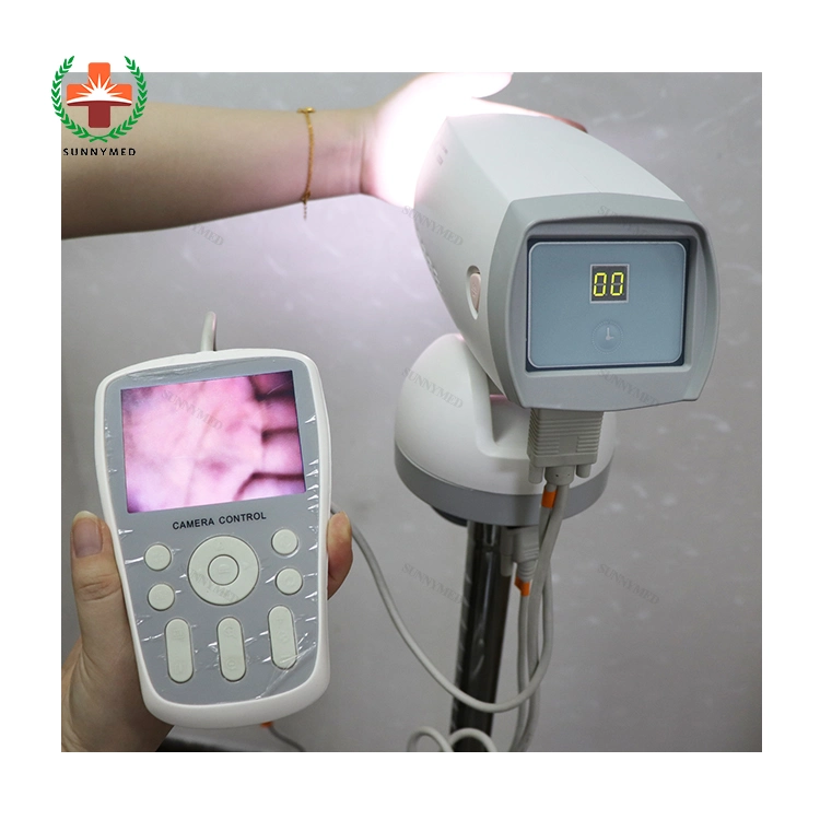 Hospital Electronic Video Colposcopy Examination Colposcope