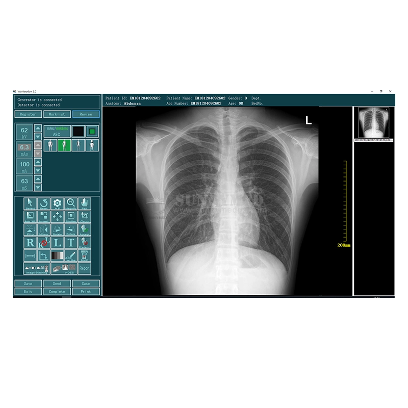 Sy-D019n la mejor calidad portátiles digitales Dr máquina de rayos X Imaging System