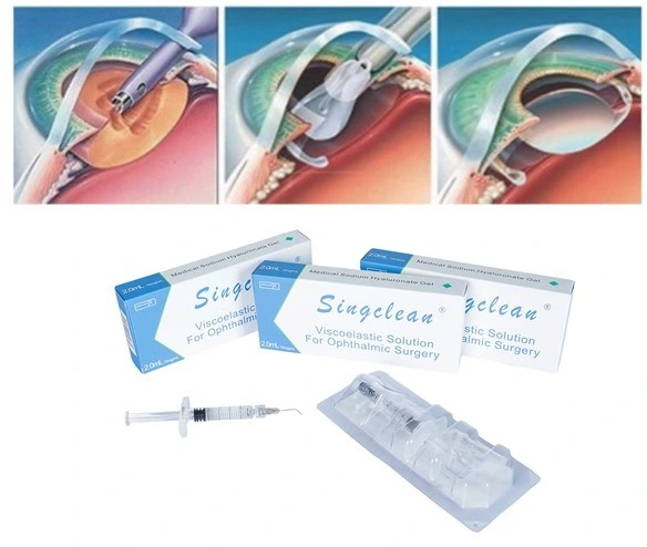 Sodium Hyaluronate Injection Eye Surgery für Filtering und sekundäre Linse Implantation