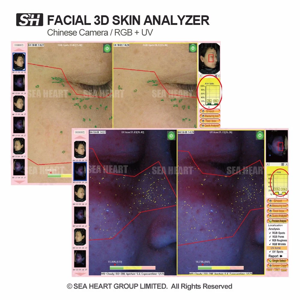 Popular Skin Analyzer Machine with RGB and UV Spectrum