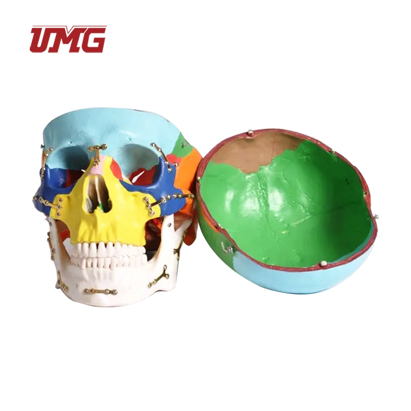 Colorful Skull Model Anatomical with Titanium Plate for Medical Training