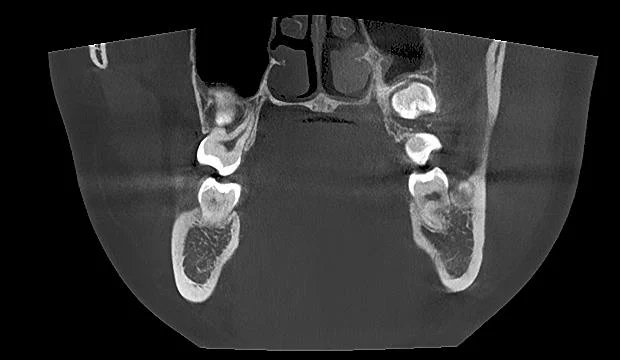 Smart 3D 2D Medical Digital panorámica Cephalométrica CBCT Dental rayos X. Equipo para el Diagnóstico Endodontico con certificado CE