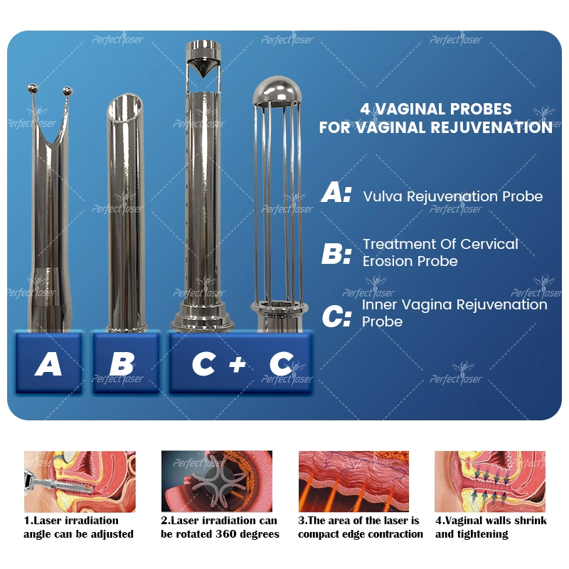 CE/FDA/RoHS Cirugía CO2 equipos de belleza para la eliminación de pigmentos láser