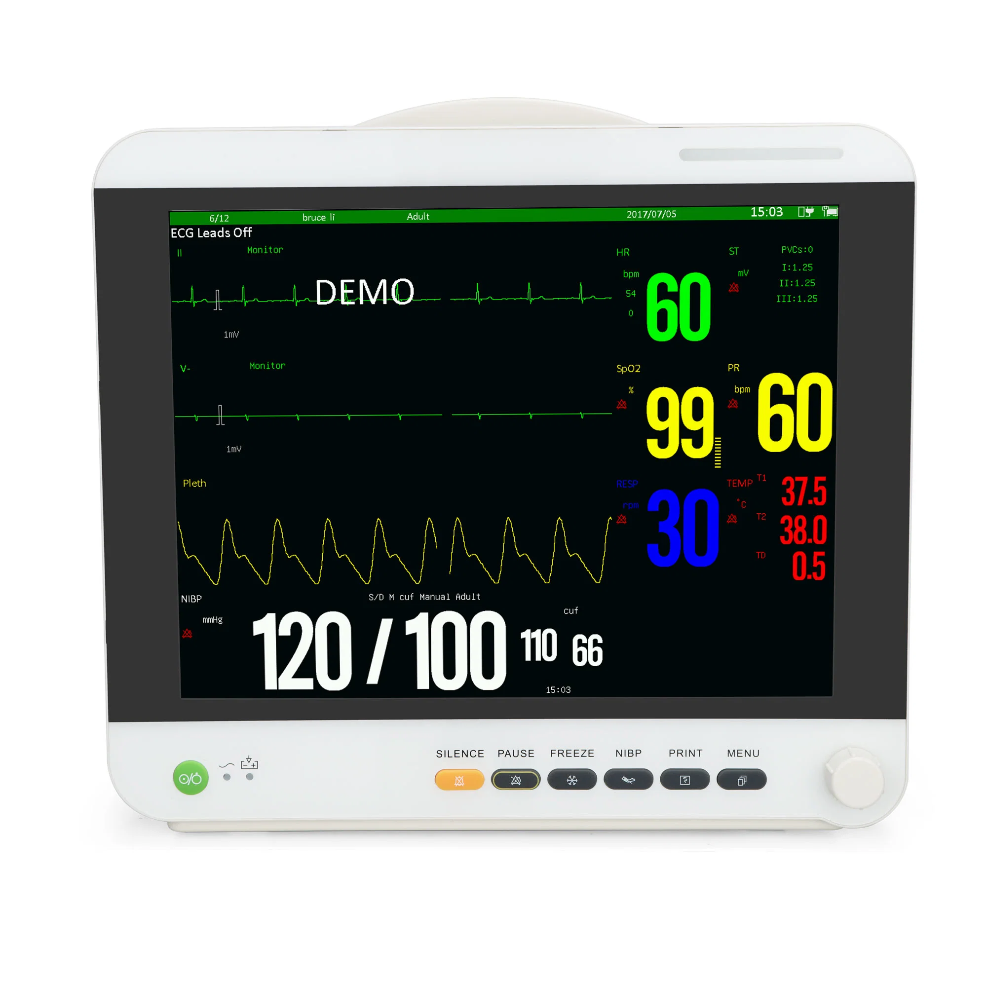 جهاز مراقبة المرضى Sinnor Snp9000ia قياسي بحجم 15 بوصة بقدرة 5 PARA من نوع Bedside مع ملحقات كاملة