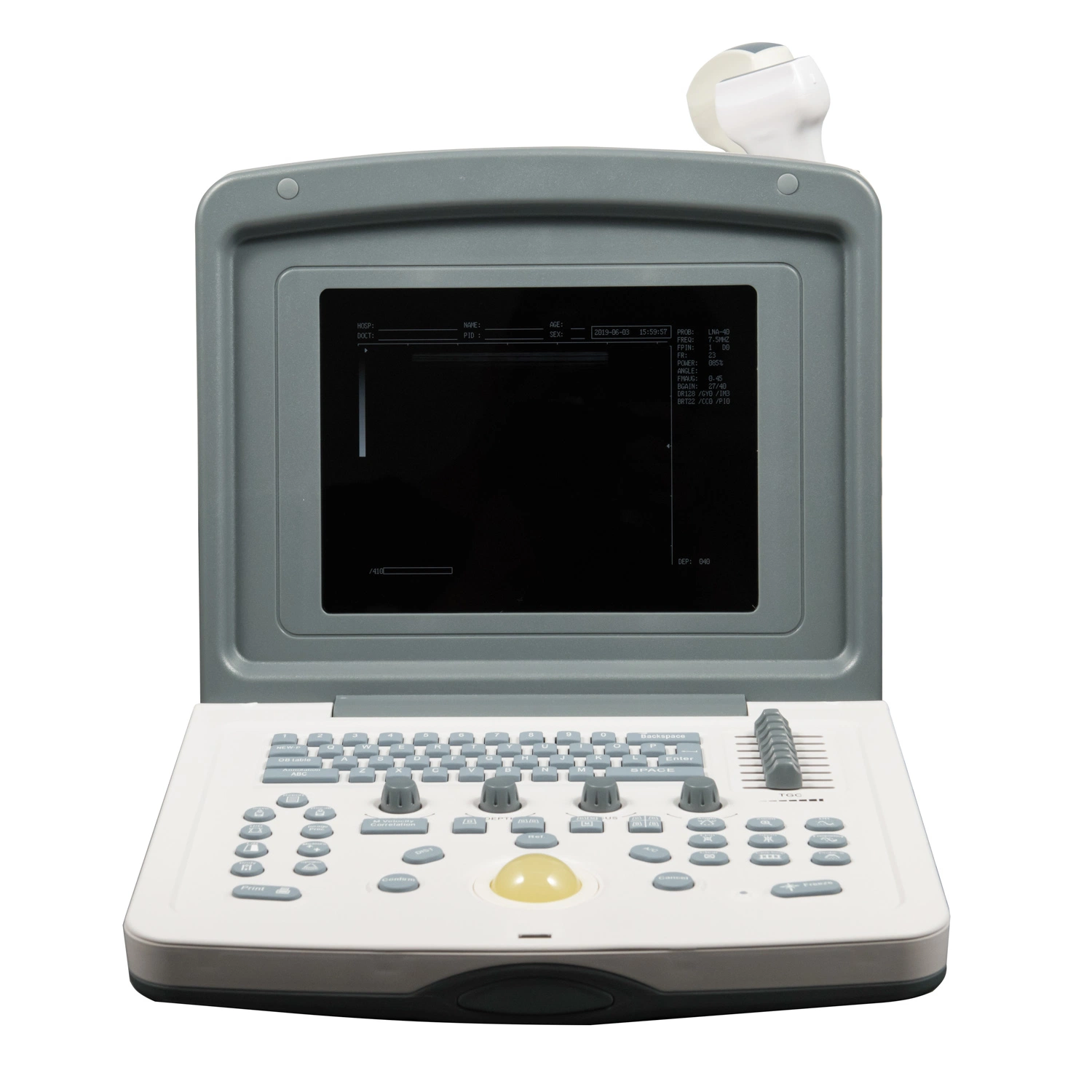 (MS-P800) Medical Full Digital Portable Black and White Ultrasound Scanner