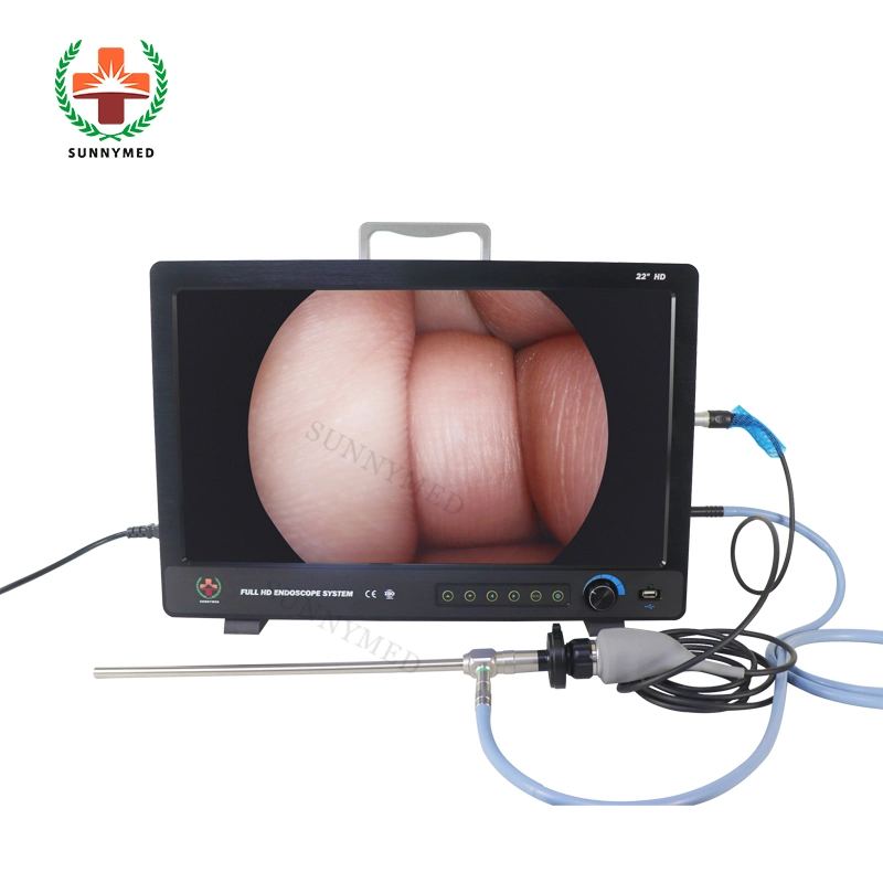 Sy-PS050 Medical 1080P HD Portable Endoscopic/Endoscope HD Camera System for Urology