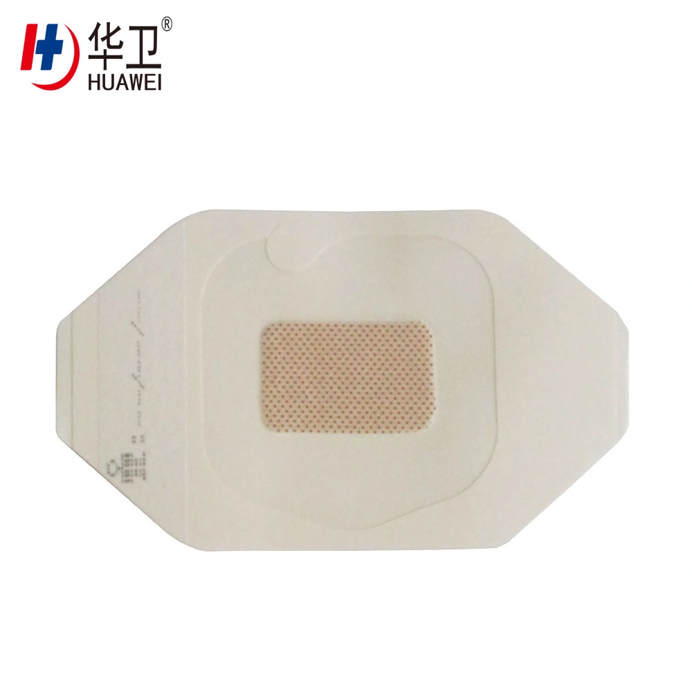 Medical Adhesive Wound Dressing (With or without Absorb Pad) Transparent Wound Dressing