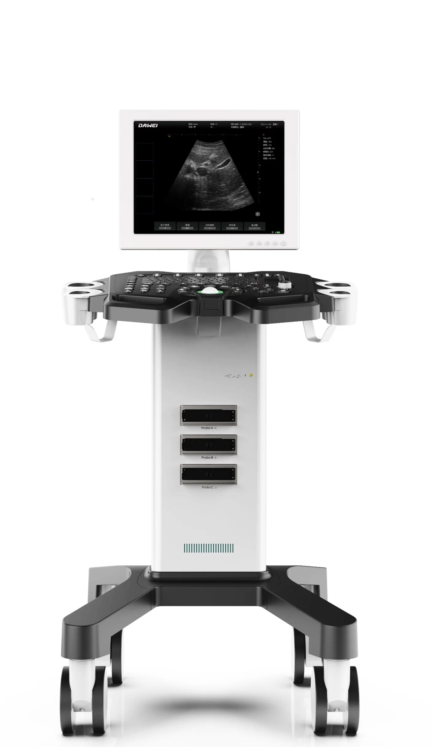 15 Inch HD Iamge Bw Medical Ultrasound Scanner for Clinics Health Centers