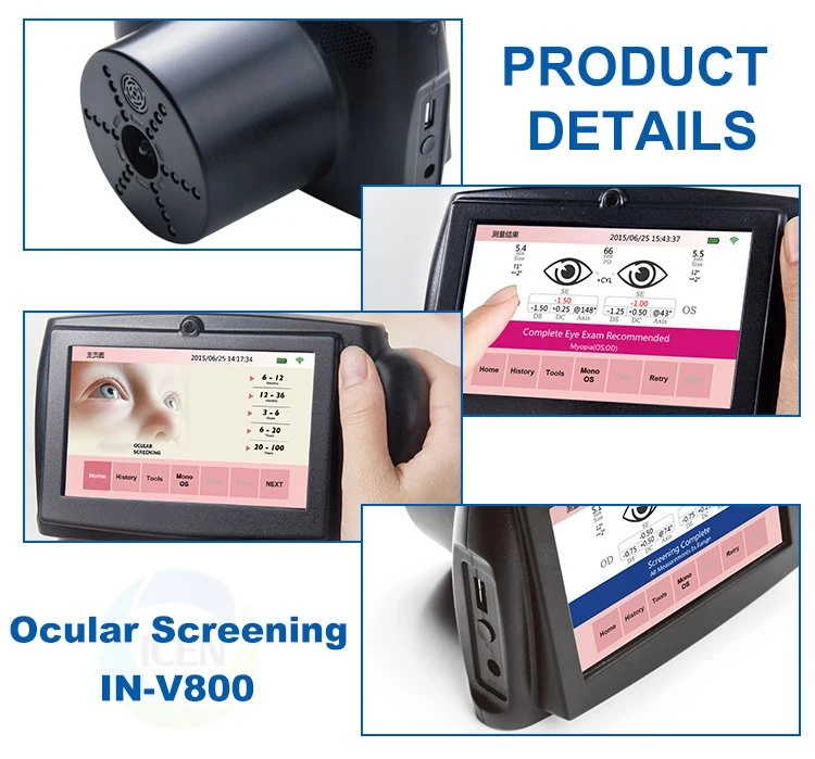 Medical High quality/High cost performance  China Ophthalmic Fundus Retinal Camera