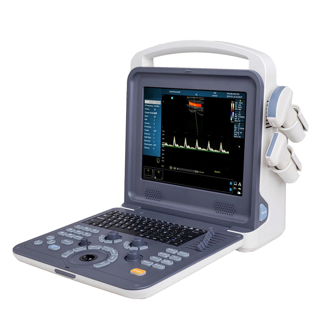 Medical Portable 12 Inch Color Doppler Ultrasound Machine for Pregnancy