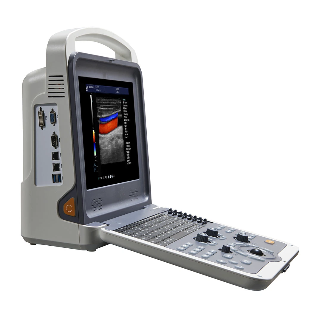 El equipo de diagnóstico médico digital portátil Doppler Color Ecógrafo 4D
