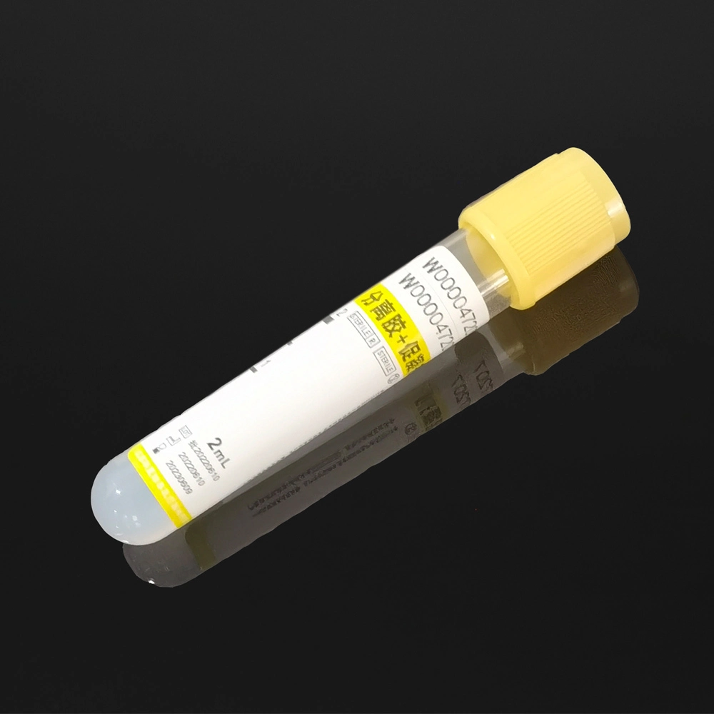 2ml 3ml 2ml~10ml EDTA Pyrogen Free Sodium Citrate Platelet Rich Clot Activator Tube