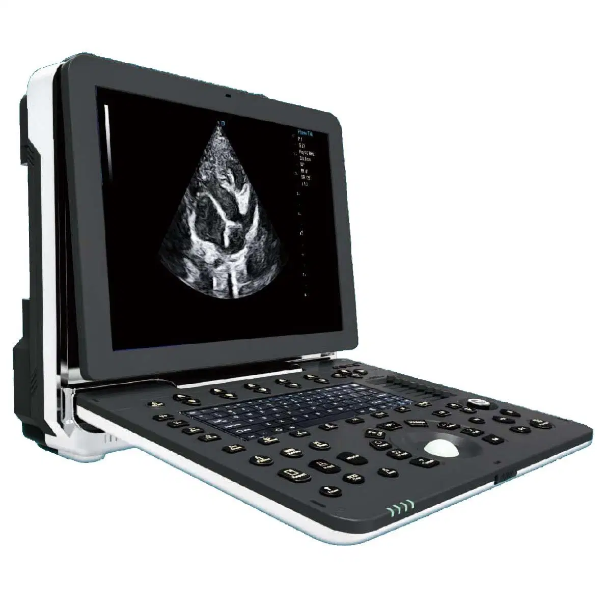 Portable Full Digital Color Doppler Veterinary Ultrasound Diagnostic Scanner