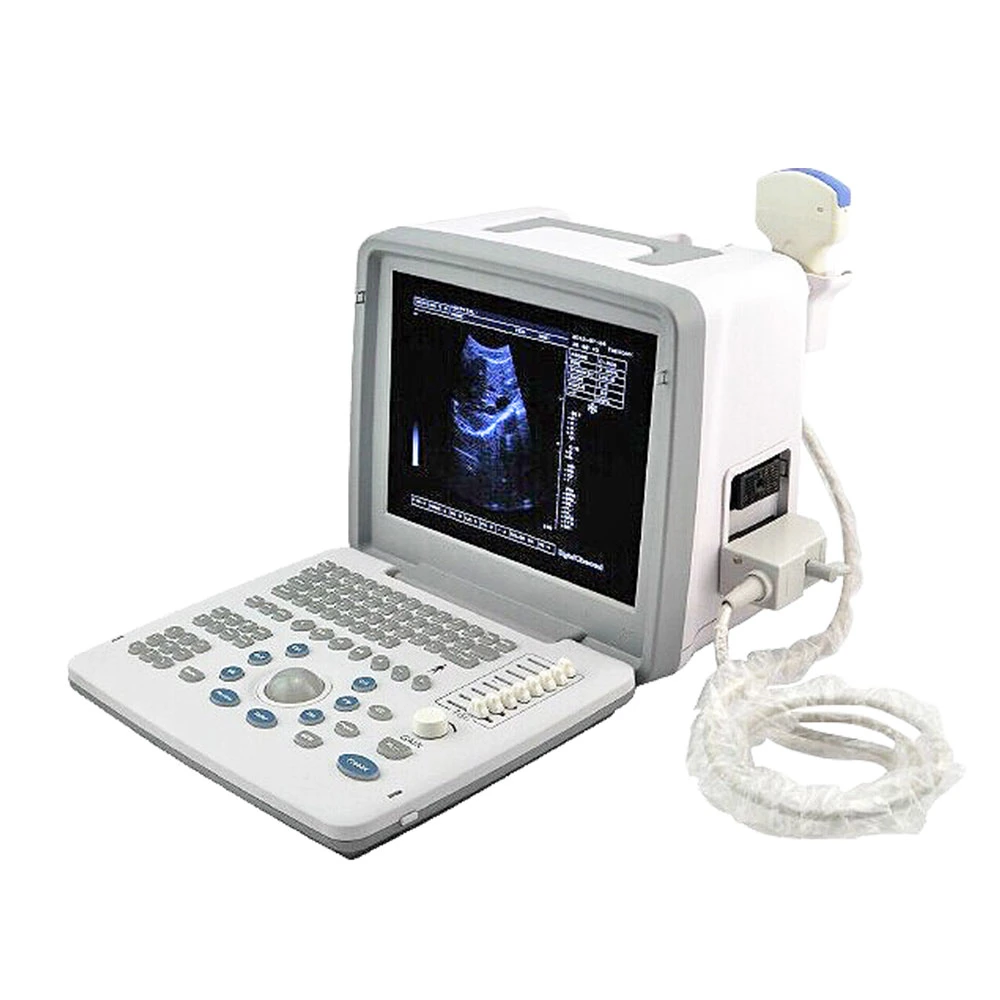 Ltub62V Cheap Diagnostic Equipment Laptop Machine Full Digital Veterinary LED Portable Ultrasound Scanner
