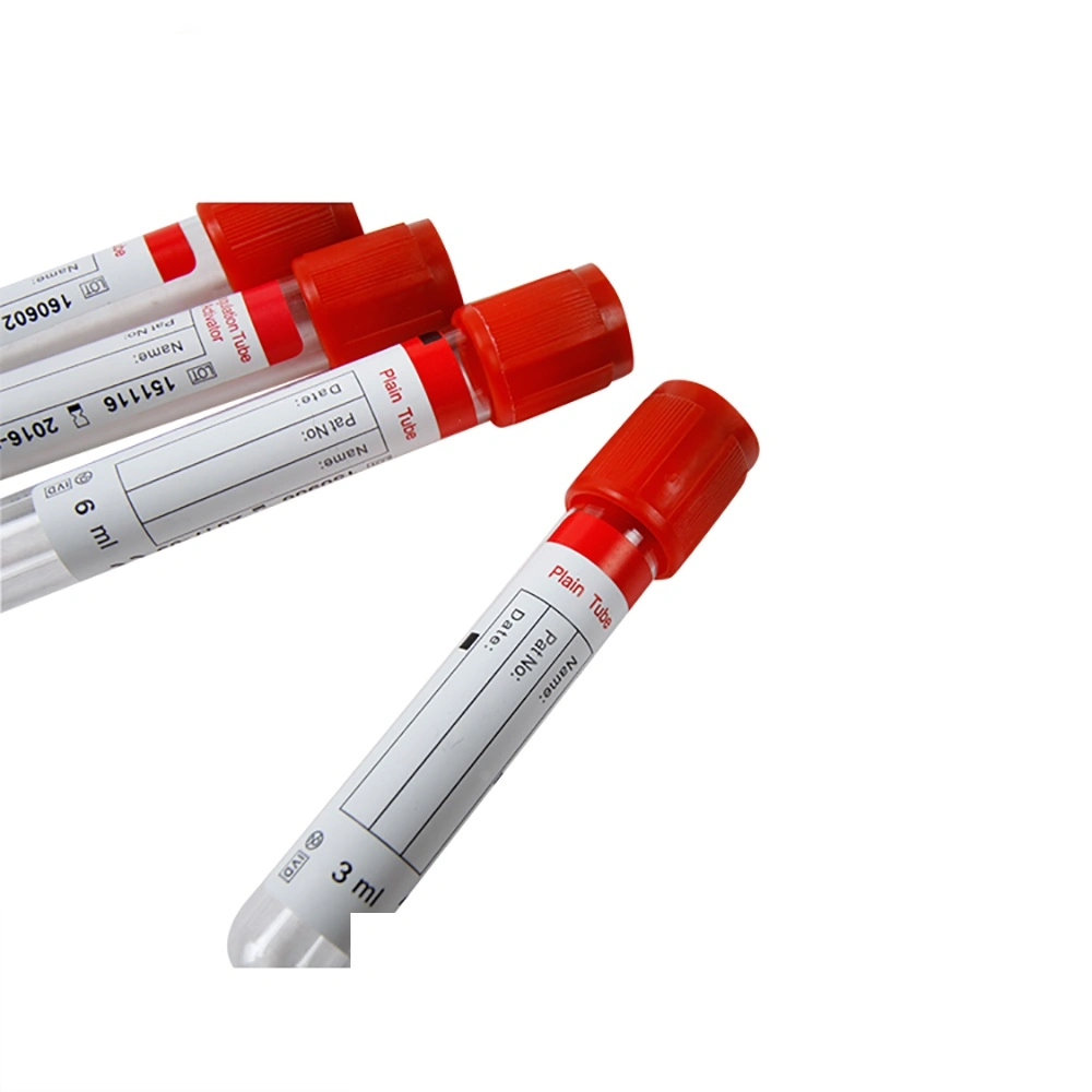 Médicos desechables, tubo de vacío de sangre se coagule tapón rojo tubo liso de activador de 1-10 ml