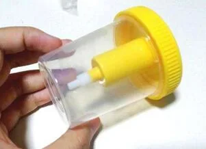 Urine Container 100ml with Needle